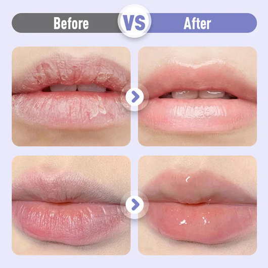 ❣️Plumping & Anti-Wrinkle Hydrating Lip Serum