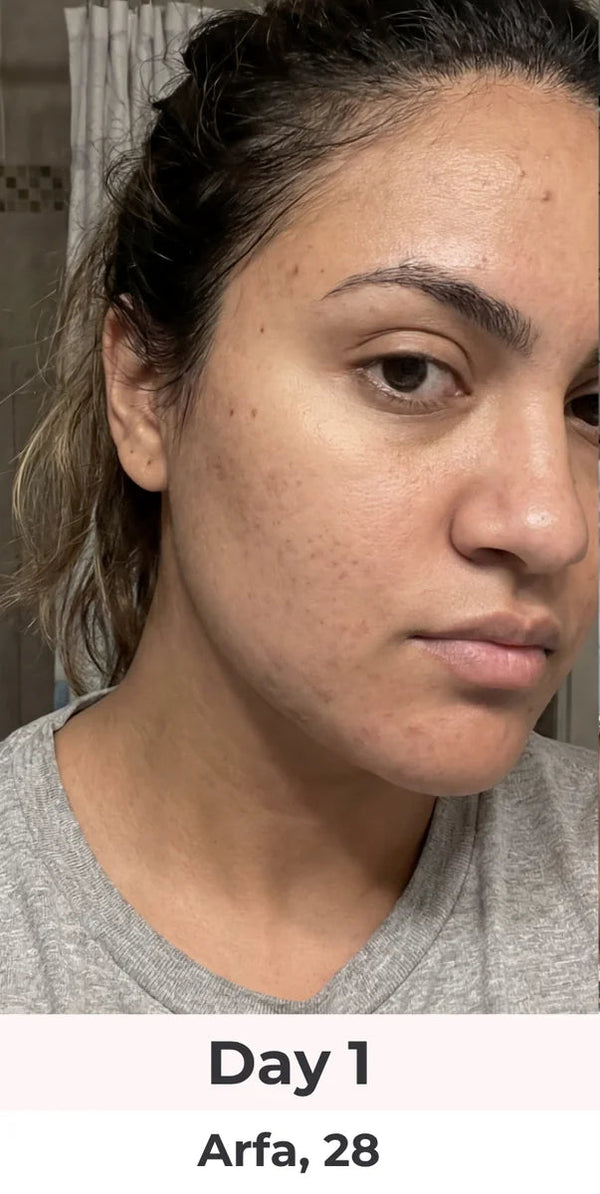 Day 0