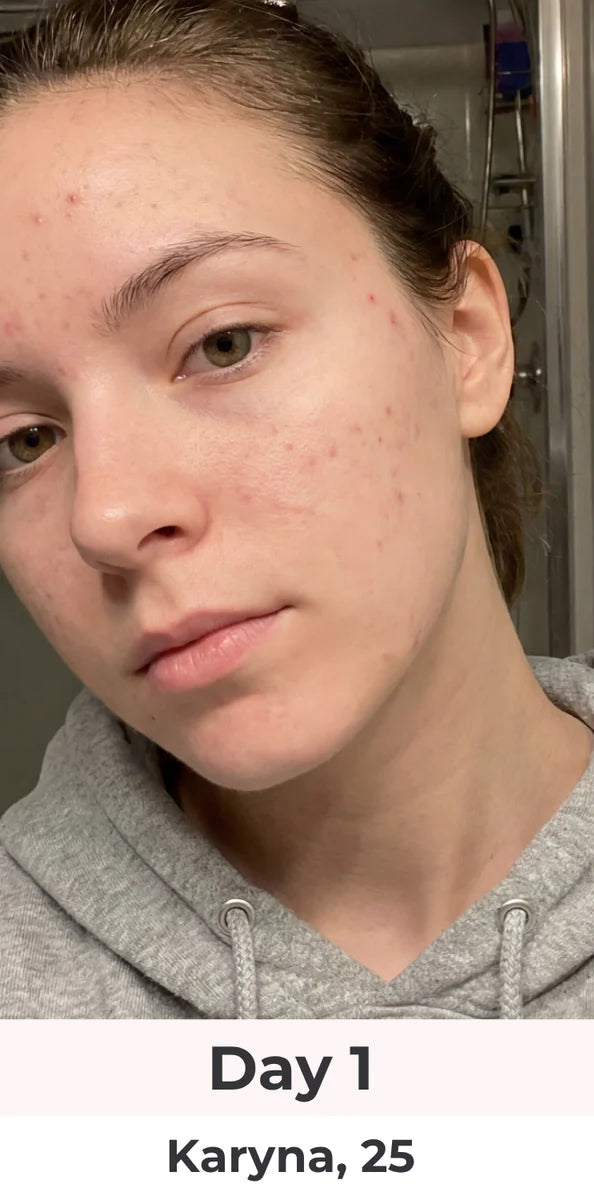 Day 0